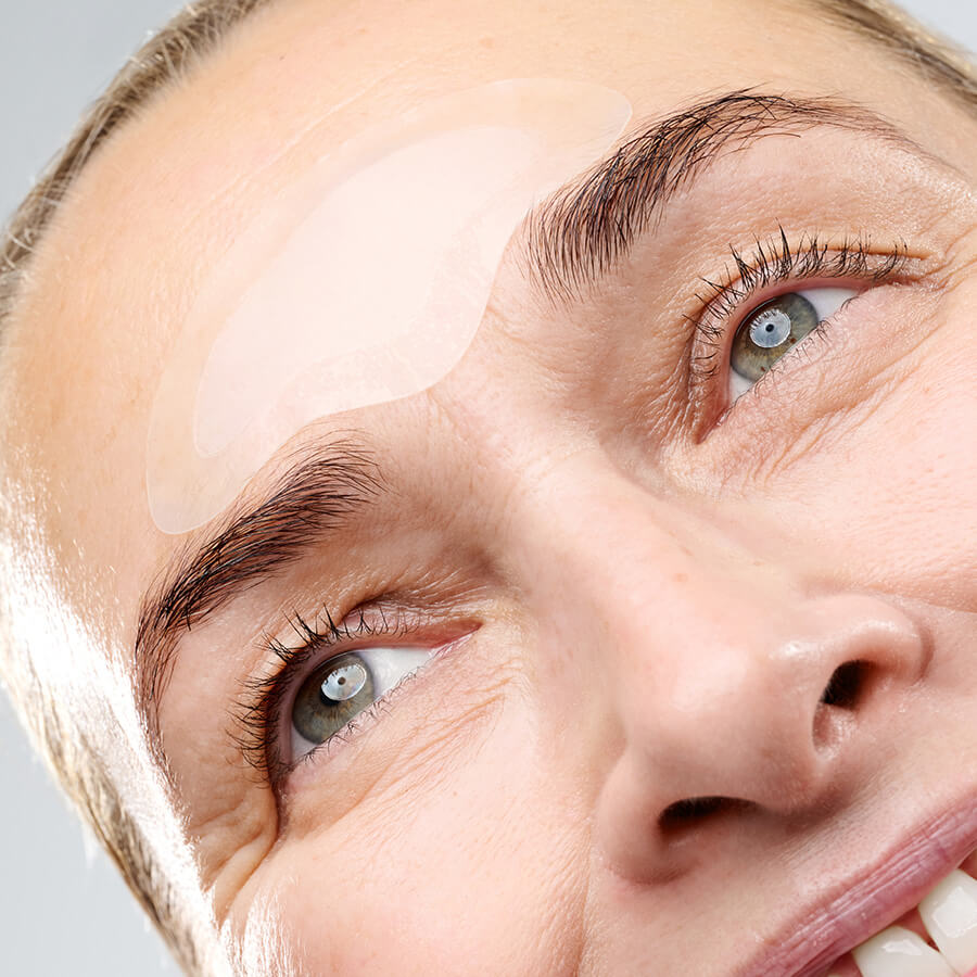 CurrentBody Skin RF Microneedling Treatment